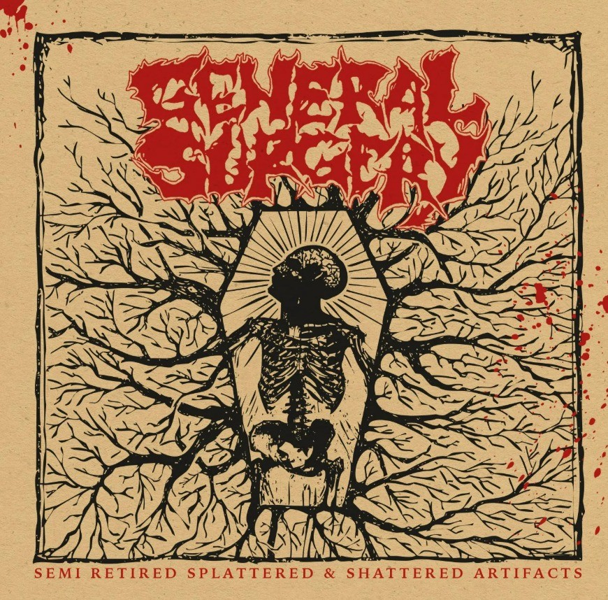 General Surgery - Semi Retired Splattered e Shattered Artifacts